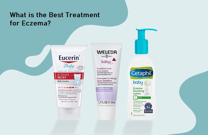 What is the Best Treatment for Eczema?